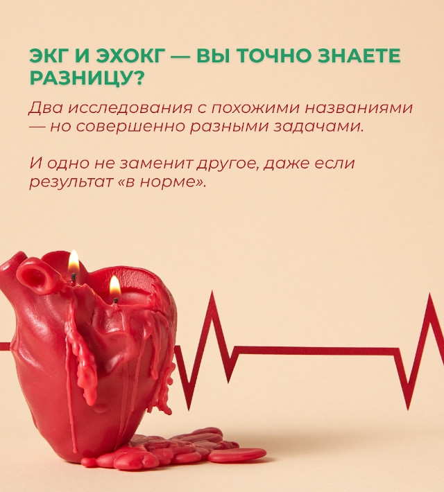 ЭКГ и ЭхоКГ - вы точно знаете разницу?