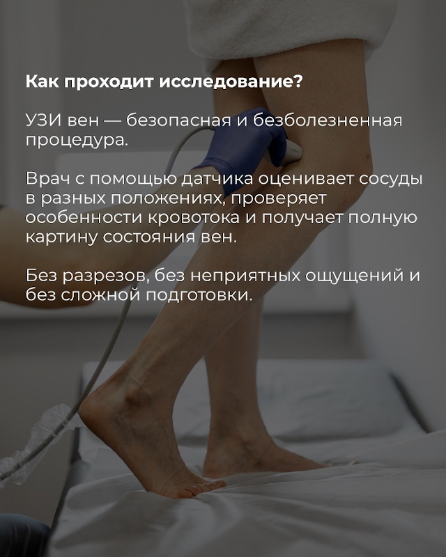 как проходит узи вен