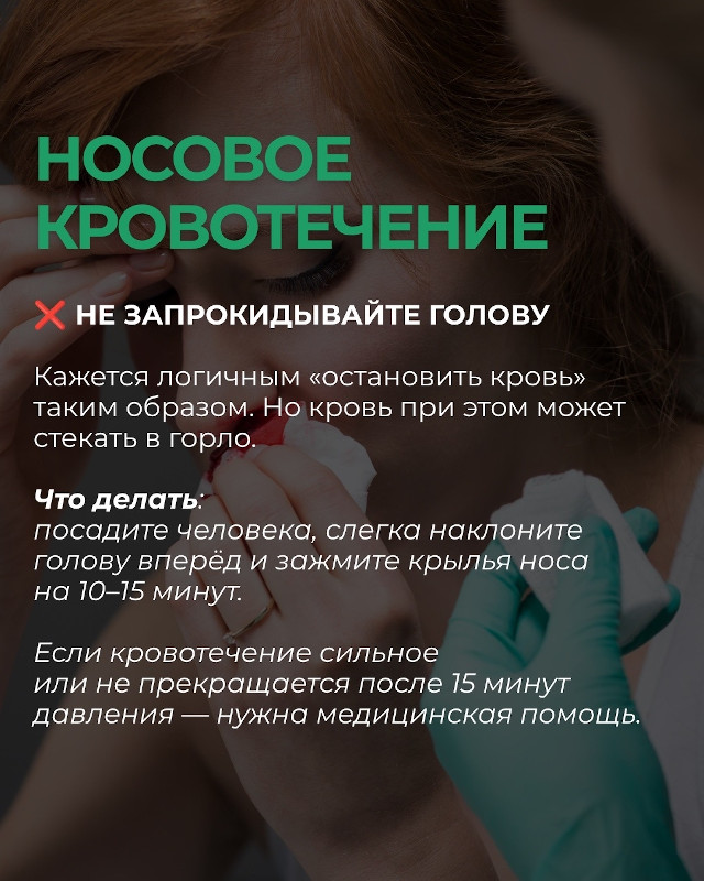 Носовое кровотечение