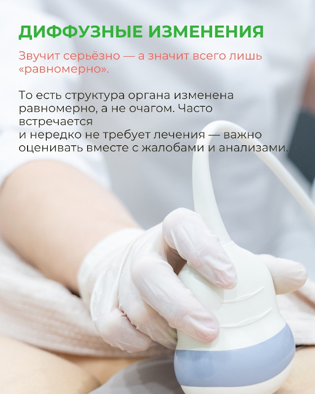 диффузные изменения