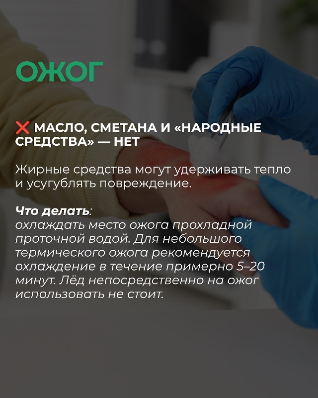 Ожог